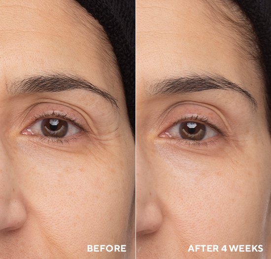 Retinol Eye Renewal <br> Feszesítő szembalzsam lifting hatással